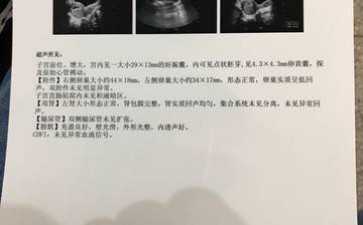 代生包儿子-广州地下医院做三代试管的成功率高吗？贵吗