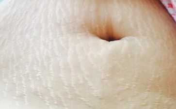 代怀多少钱-试管打降调是根据体重来计算打多少吗 代怀多少钱-试管打降调是根据体重来计算打多少吗