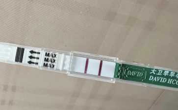 如何检查盆腔积液小编一一来介绍 如何检查盆腔积液小编一一来介绍