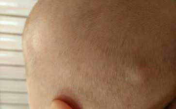 广州可以做三代试管的私立医院解析-供卵包男孩价格