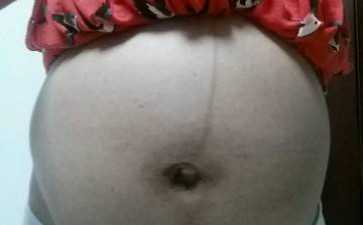 宫腔粘连术后出血几天，包成功要多少钱！~代生代怀费用