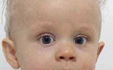 怎样去除妊娠纹可常按摩 怎样去除妊娠纹可常按摩