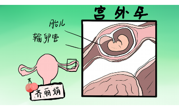 10号染色体异常胎儿还能不能留-代妈成功怀上 10号染色体异常胎儿还能不能留-代妈成功怀上