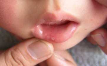 优势卵泡（最佳卵泡和内膜厚度）-代妈应聘