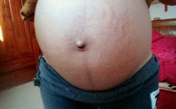 【输卵管积水治疗】输卵管积水治疗有用吗?输卵管积水治疗期间要注意什么?-助孕机构咨询电话 【输卵管积水治疗】输卵管积水治疗有用吗?输卵管积水治疗期间要注意什么?-助孕机构咨询电话