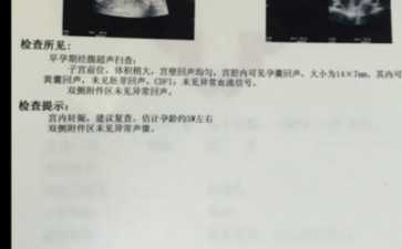 输卵管梗阻做试管需要注意什么？输卵管阻塞试管**事项及调理建议