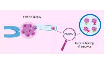格魯吉亞MMC醫院生殖專家介紹，伊戈爾·馬達利什維利醫生