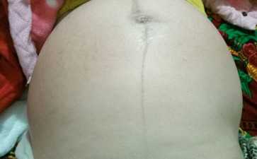 胚胎级别怎么分？胚胎分级是怎么回事-助孕公司价格