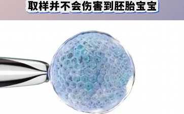 NRC醫院張金玉主任：一位有着20年臨牀經驗的生殖中心主任