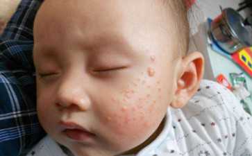 代怀多少钱-广州地贫三代试管费用明细表，基因检测价格并不高别担心